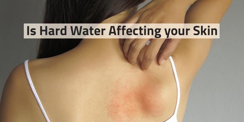 Identifying ⁢and Addressing ⁢Potential Post-Shower ⁤Skin Reactions