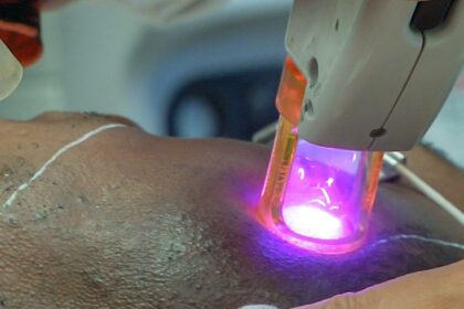 Pregnant and Considering Laser Hair Removal? Expert Insights