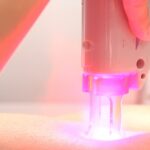 Navigating Laser Hairline Removal: Know the Risks