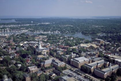 Achieve Smooth Skin: Laser Hair Removal in Annapolis MD