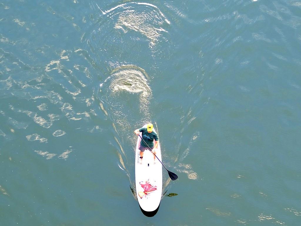 Smooth Sailing: Discover the Perks of Laser Hair Removal