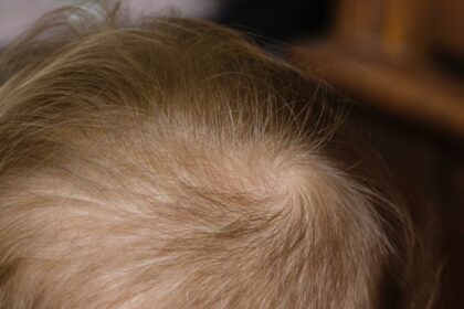 Zap That Unwanted Hair: Top Laser Salon Reviews!