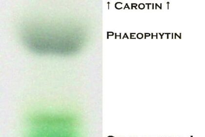 IPL Photofacial Wonders: How Long Do Results Really Last?