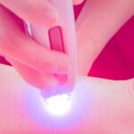 Achieve Smooth Skin: Laser and Light Hair Reduction for All