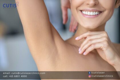 Underarm Smoothness Unveiled: Laser Hair Removal Review