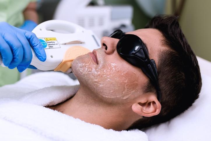 Breakthrough: Laser Hair Reduction Success on Black Skin