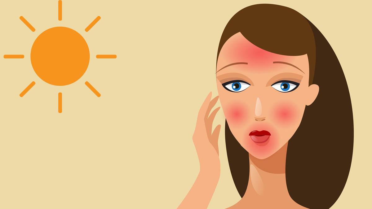 Sun Exposure and Laser Hair Removal: Insights from Hollywood