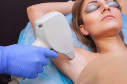 Radiant & Smooth: Laser Hair Removal’s Facial Wonders