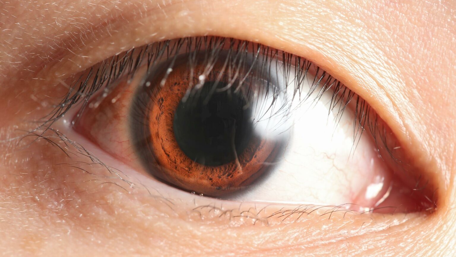 Eyes Wide Open: Laser Hair Removal Safety Tips