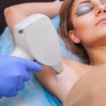 Laser Hair Removal: What’s the Real Aftermath?