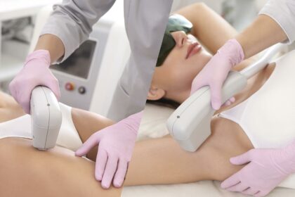 Unveiling Diode Laser: Embrace Permanent Hair Reduction