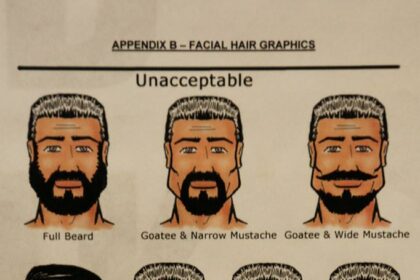 Zapping Away: Facial Hair Laser Treatment Insights