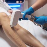 Revolutionizing Hair Removal: Painless Motus AX Technology