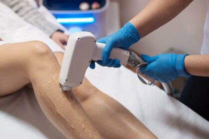 Revolutionizing Hair Removal: Painless Motus AX Technology