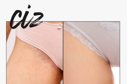 Silky Smooth Secrets: Bikini Area Laser Aftercare Tips 2 Silky Smooth Secrets: Bikini Area Laser Aftercare Tips