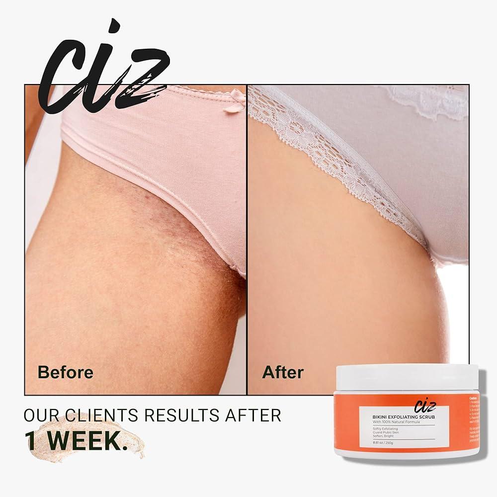Silky Smooth Secrets: Bikini Area Laser Aftercare Tips