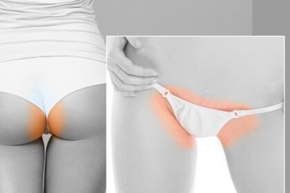 Sun-Kissed Smooth: Navigating Bikini Laser Side Effects