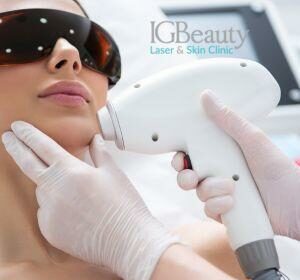 Unveiling the Hidden Side: Hair Removal Machine Effects