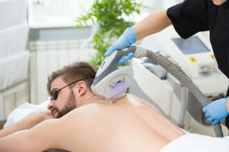 Shedding Light: Side Effects of Candela Laser Hair Removal