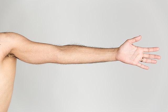 Smooth Transformations: Arm Laser Hair Removal Results