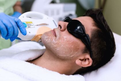 Smooth But Wary: Laser Hair Removal’s Hidden Secrets!