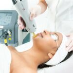 Glow On: Essential Aftercare for Candela Laser Hair Removal