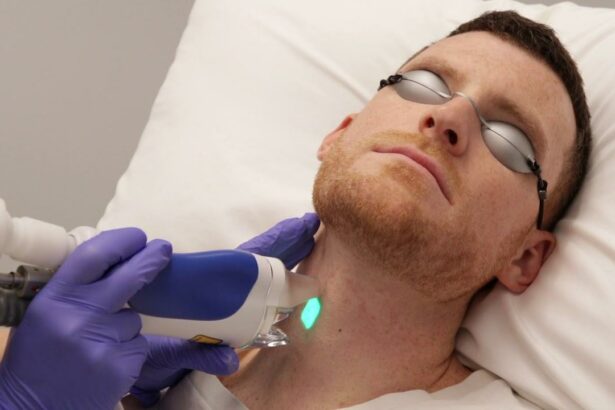 Splendor X: Unveiling the Mysteries of Hair-Free Bliss