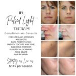 Why Isn’t My IPL Treatment Working? Discover the Truth!