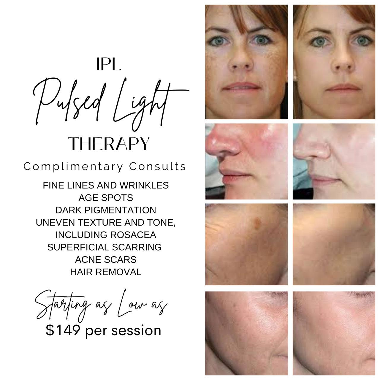 Why Isn’t My IPL Treatment Working? Discover the Truth!