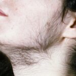 Zap Unwanted Hair: Top Deals on Pro Laser Machines!