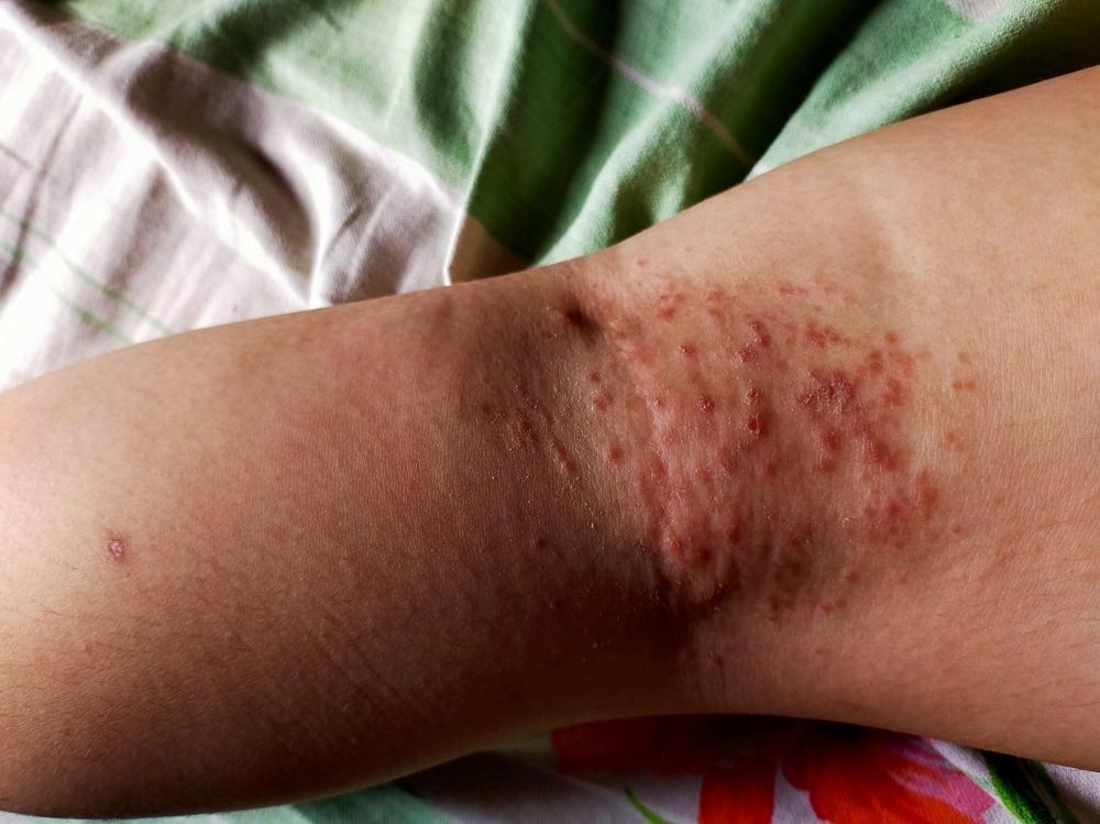 Guard Against Infections
