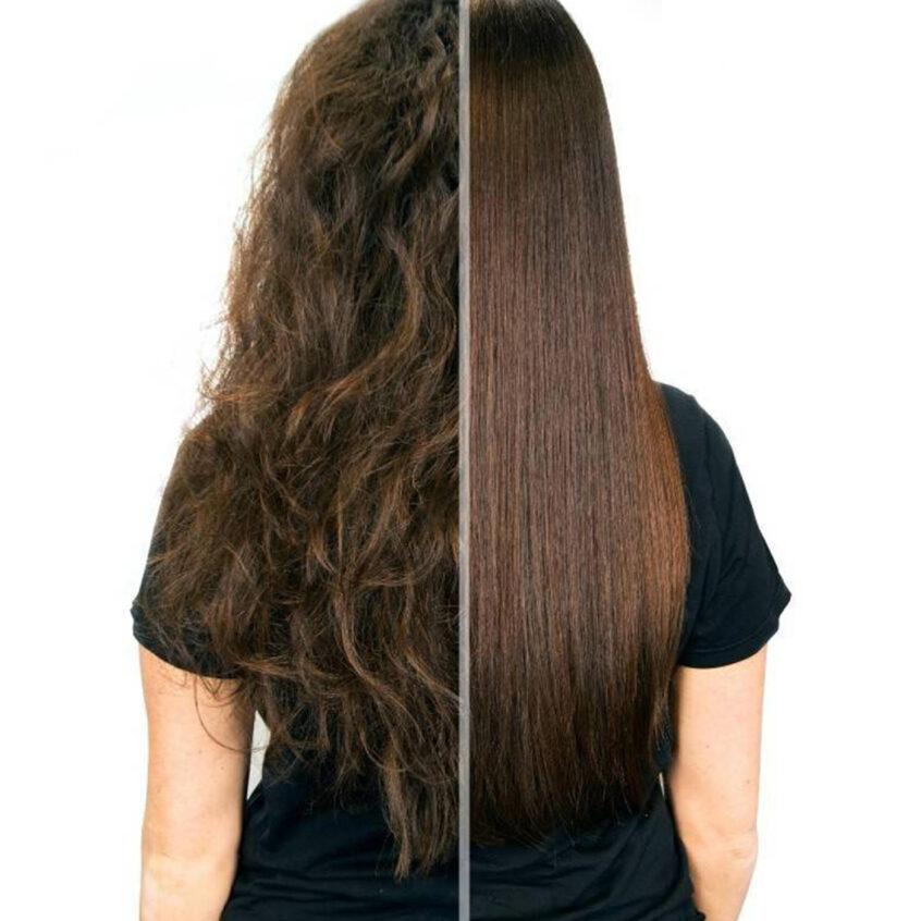 Maintaining Smoothness: Post-Treatment Care You Need to Know
