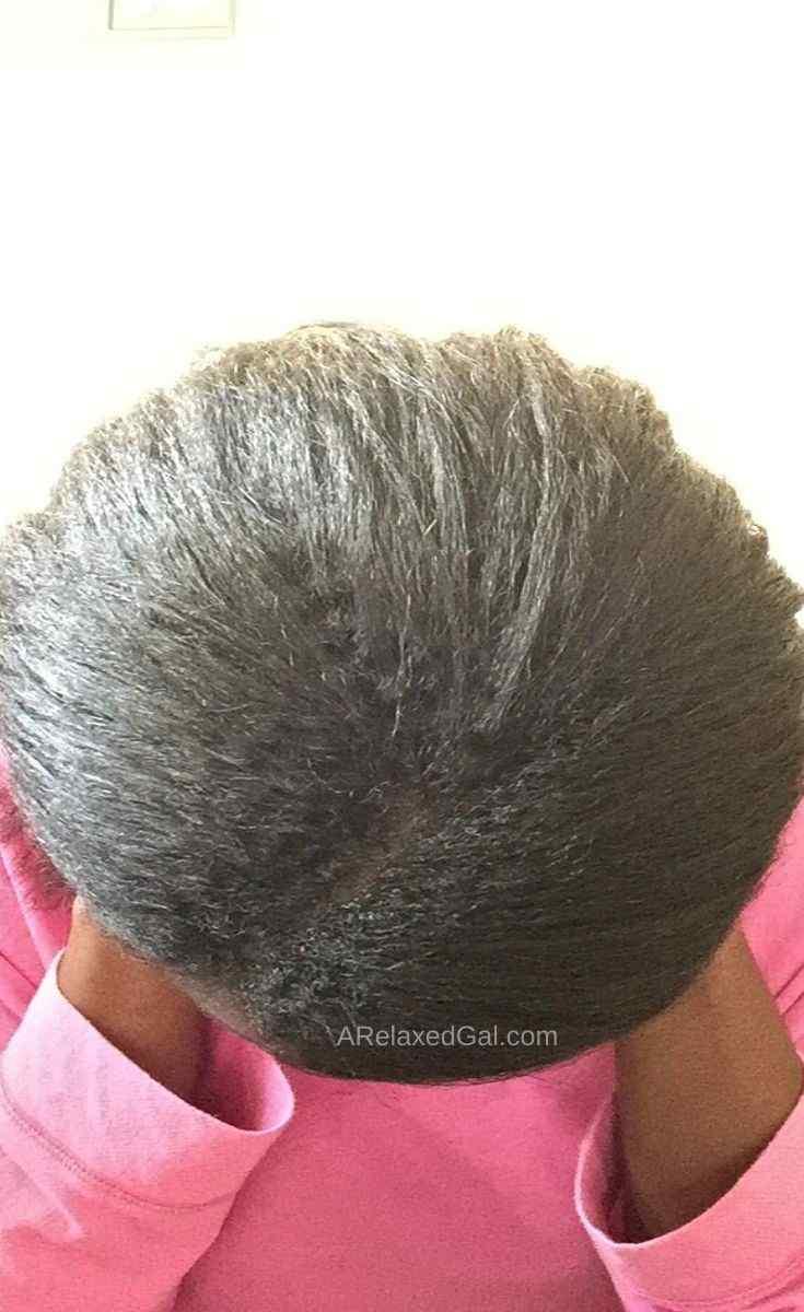 Managing Regrowth: Tips​ for ⁣Handling Hair After ‌Stopping