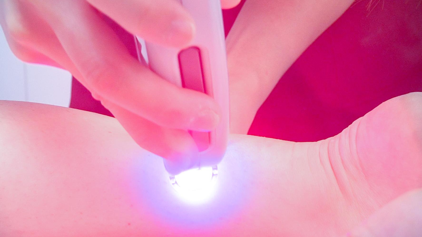 Post-Laser Care: Essential Tips for Smooth Recovery