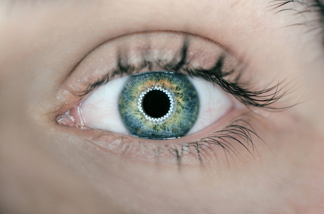 Photo Eye surgery