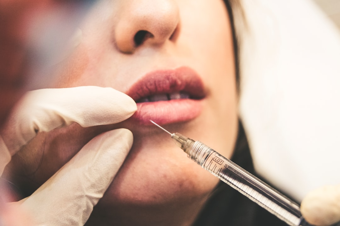 Photo Dermatologist, laser machine