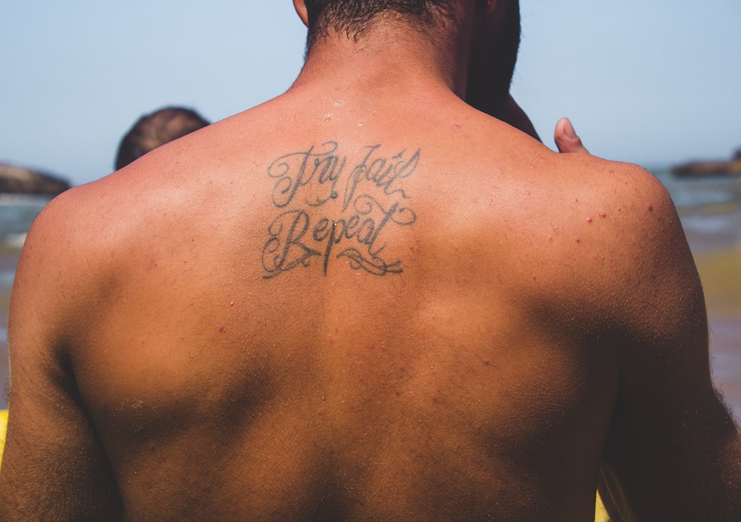 Photo tattoo removal