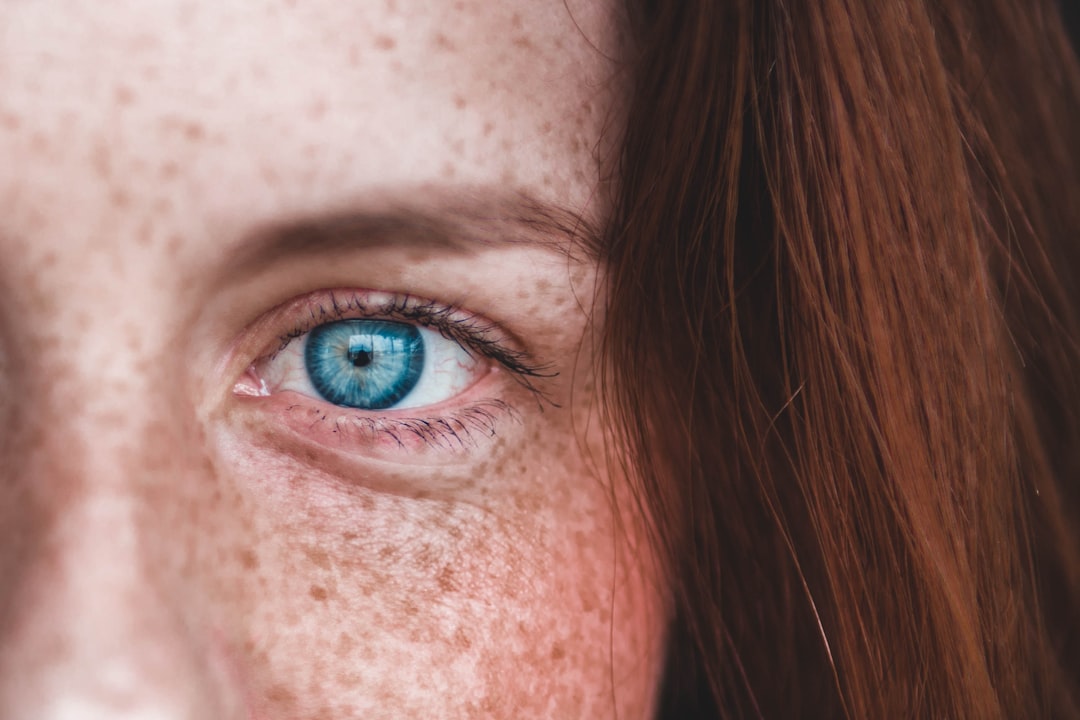Photo Skin treatment