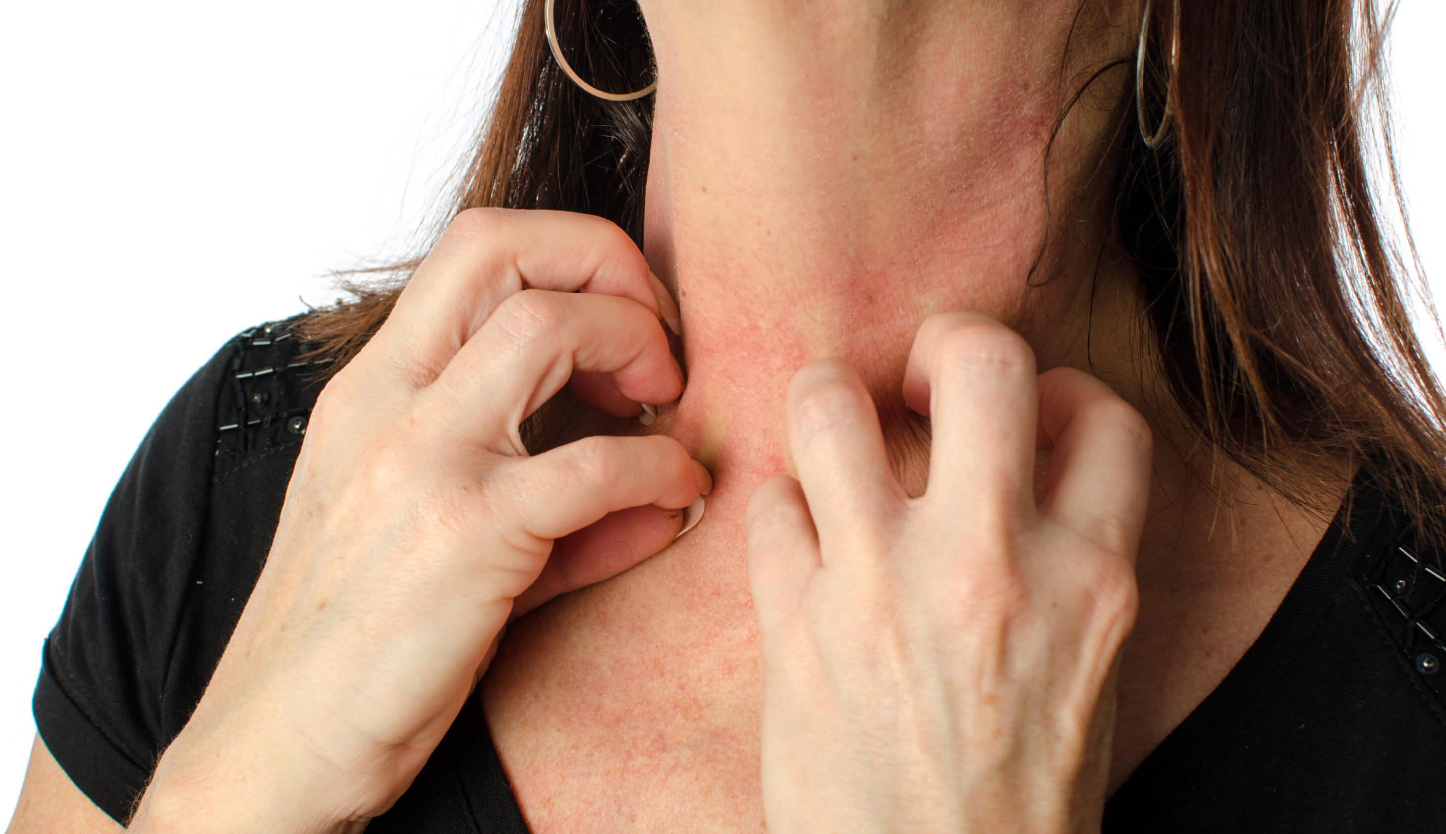 Say No to Scratching and Exfoliating the Treated Area