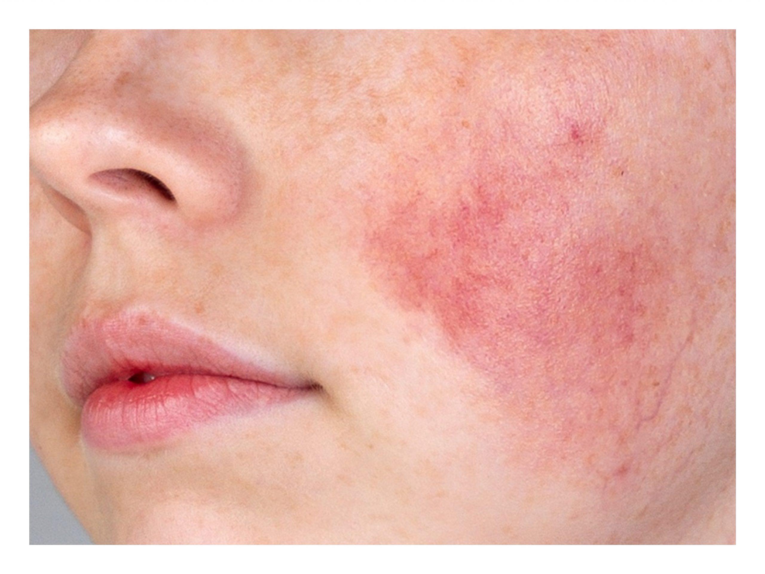 Sensitive Skins Best Friends