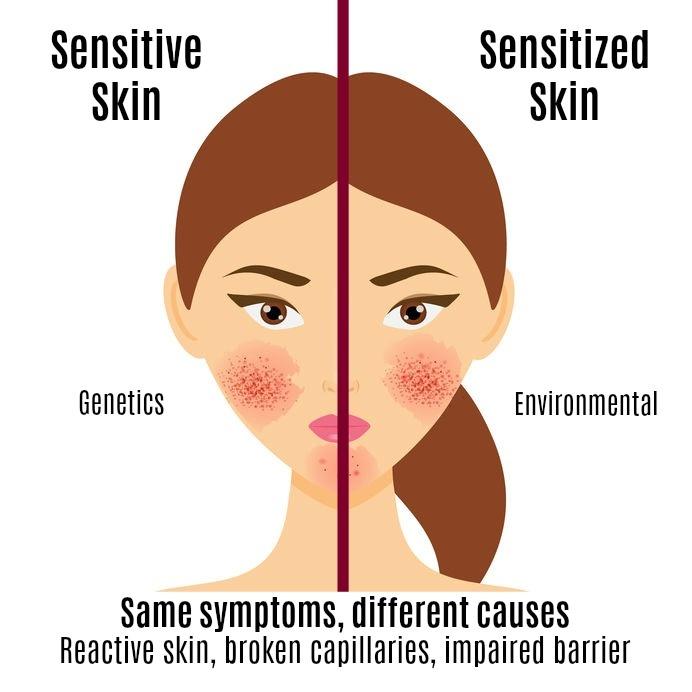 Sensitive Skin? Products That Wont Irritate