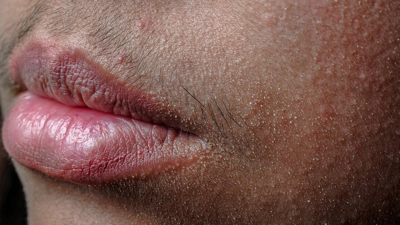 Understanding the Causes: Why Upper Lip Hair ⁤Appears