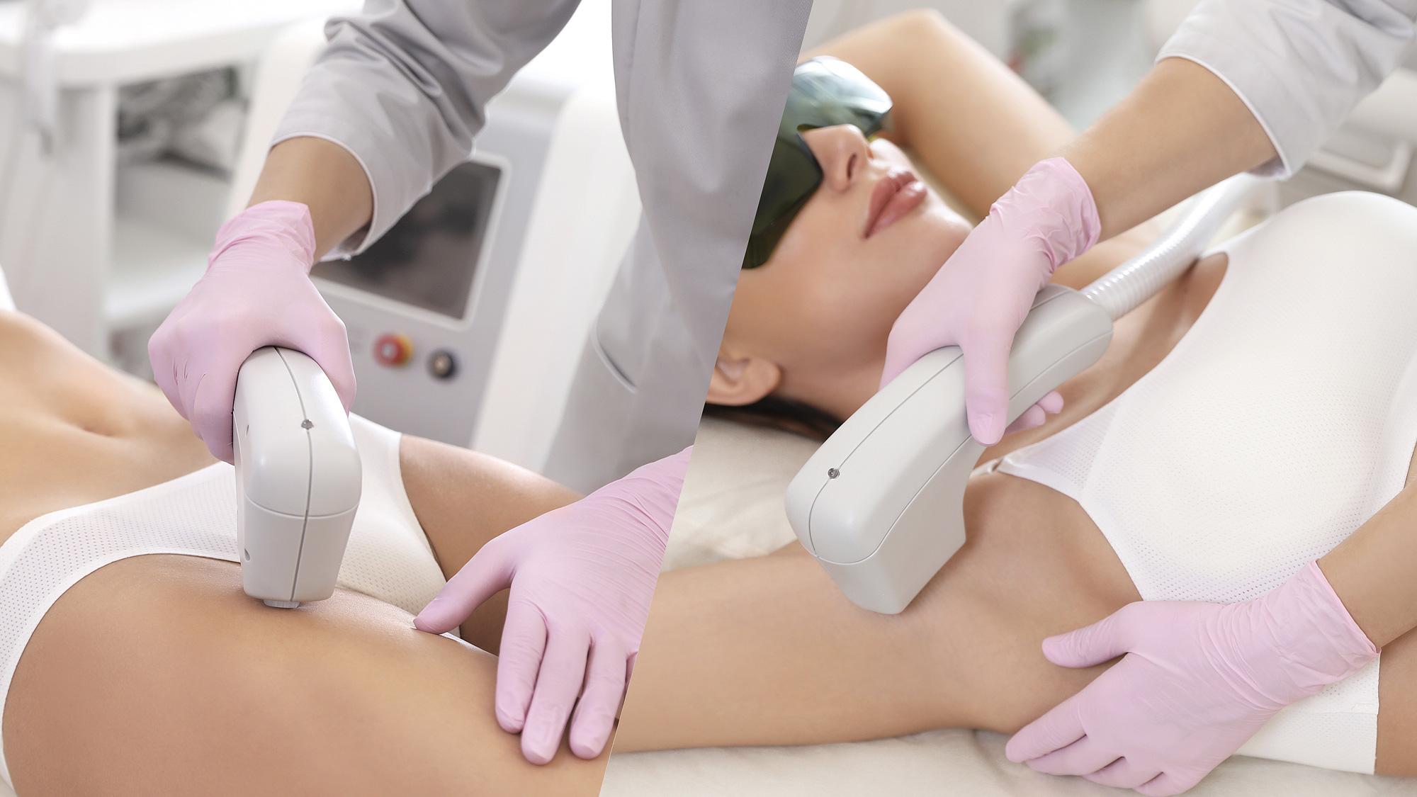 Bye-Bye Razor Burn: Why Diode Laser Is Kinder to Your Skin