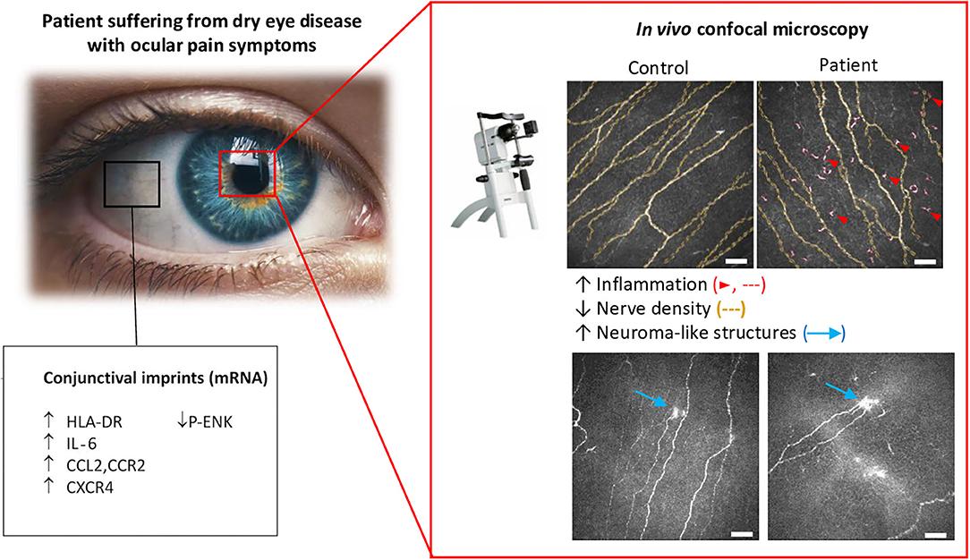 Unlocking the Secrets ⁤of Corneal ‌Nerve Anatomy