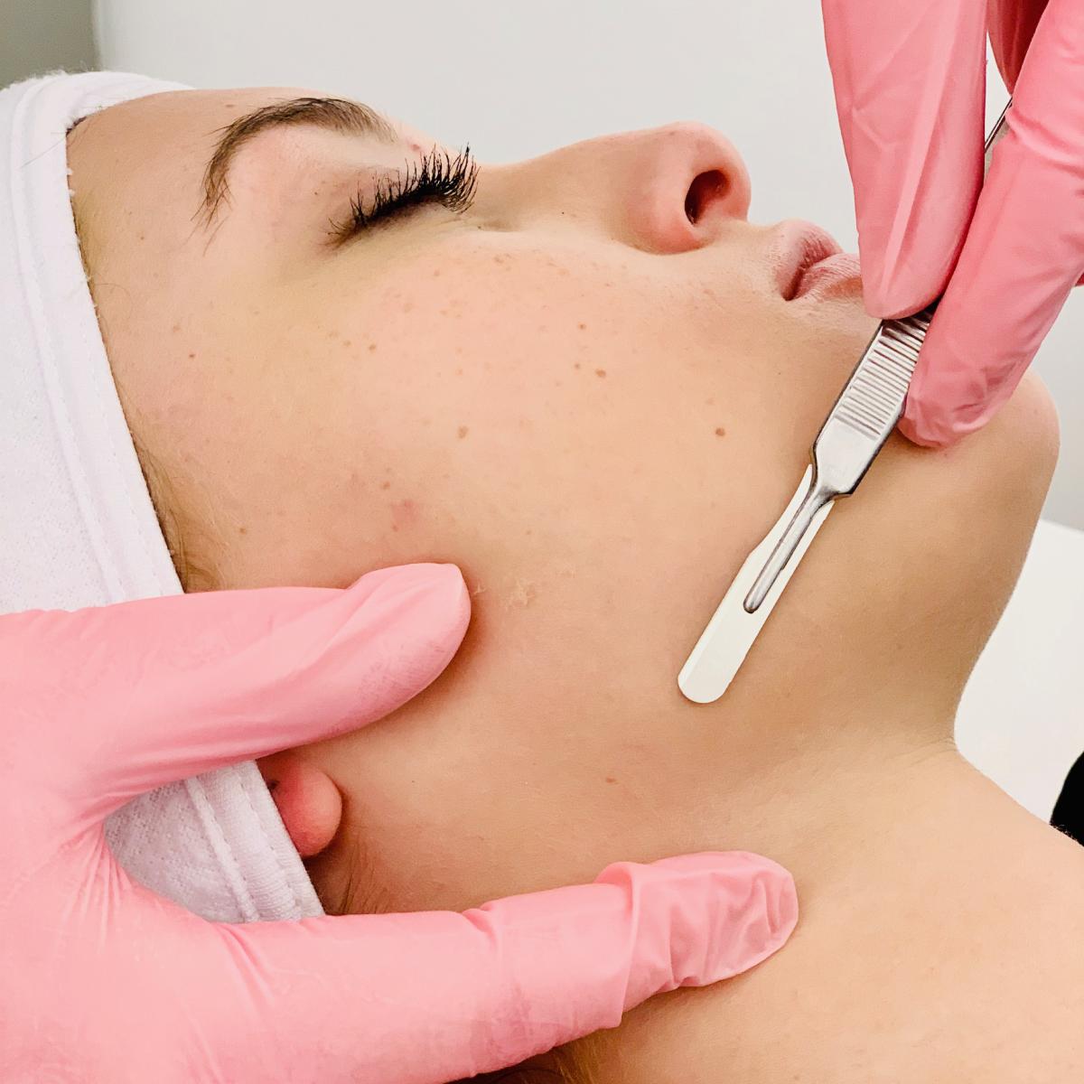 Skin Deep: Expert Tips for Post-Dermaplane Bliss