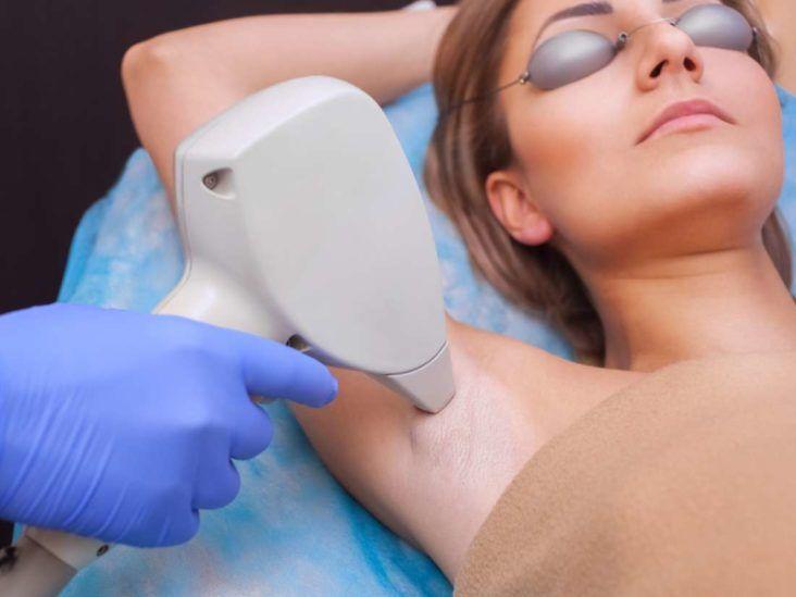 Effortless Beauty: How Laser Hair Removal Machines Transform Your Routine