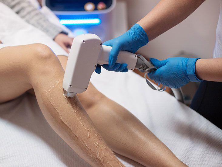 Timing is Everything: When to Schedule Hair Removal Sessions