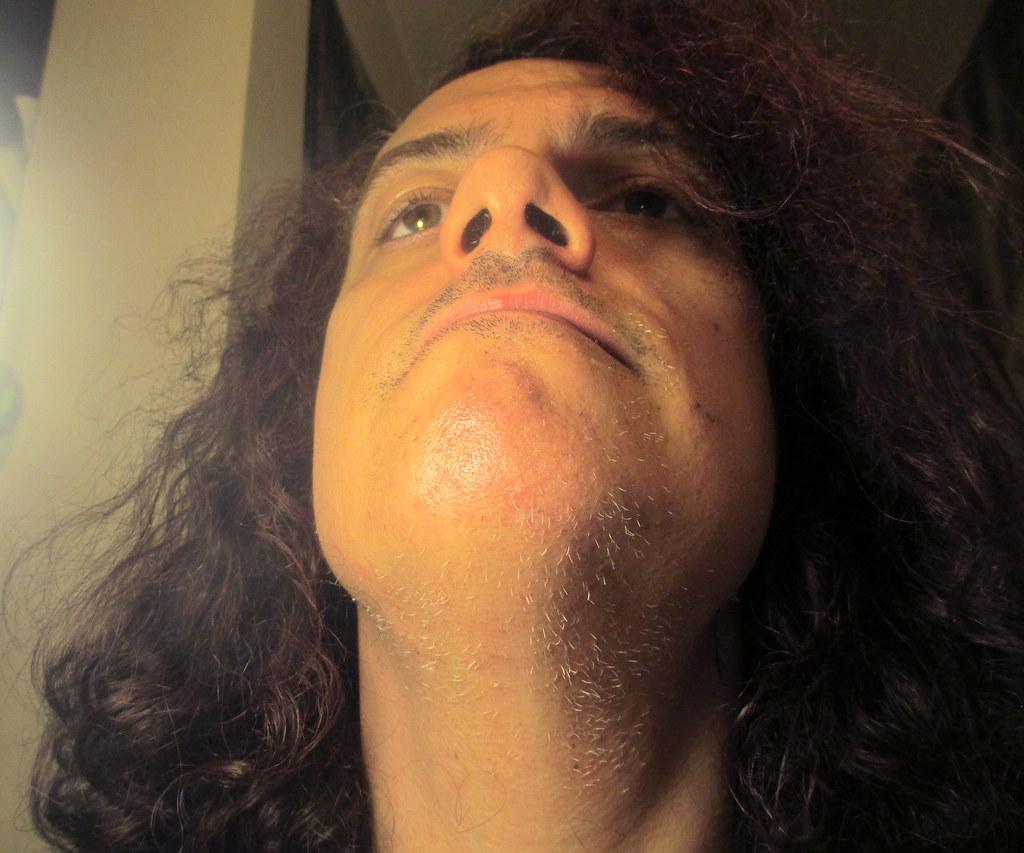 Radiant Revival: Navigating Facial Laser Hair Removal Recovery