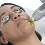 Smooth Solutions: Pros and Cons of Facial Laser Hair Removal