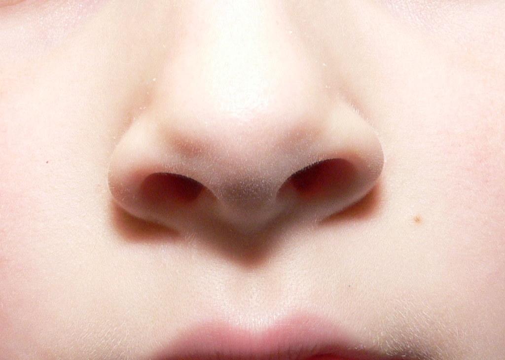 Zap Zap! Tips and Tales of Nose Laser Hair Removal